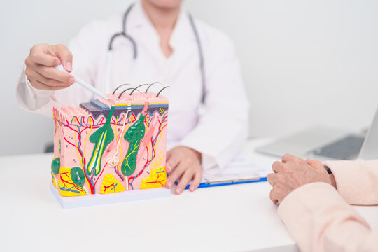 woman Patient consultation Dermatologist with anatomy of skin and hair. Skin disease and Hair loss, Systemic Lupus Erythematosus or SLE, world lupus day, May Melanoma and Skin Cancer Awareness month