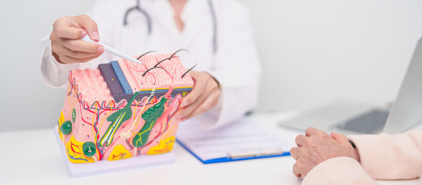 woman Patient consultation Dermatologist with anatomy of skin and hair. Skin disease and Hair loss, Systemic Lupus Erythematosus or SLE, world lupus day, May Melanoma and Skin Cancer Awareness month