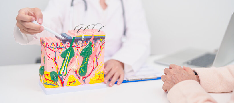 woman Patient consultation Dermatologist with anatomy of skin and hair. Skin disease and Hair loss, Systemic Lupus Erythematosus or SLE, world lupus day, May Melanoma and Skin Cancer Awareness month