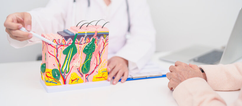 woman Patient consultation Dermatologist with anatomy of skin and hair. Skin disease and Hair loss, Systemic Lupus Erythematosus or SLE, world lupus day, May Melanoma and Skin Cancer Awareness month