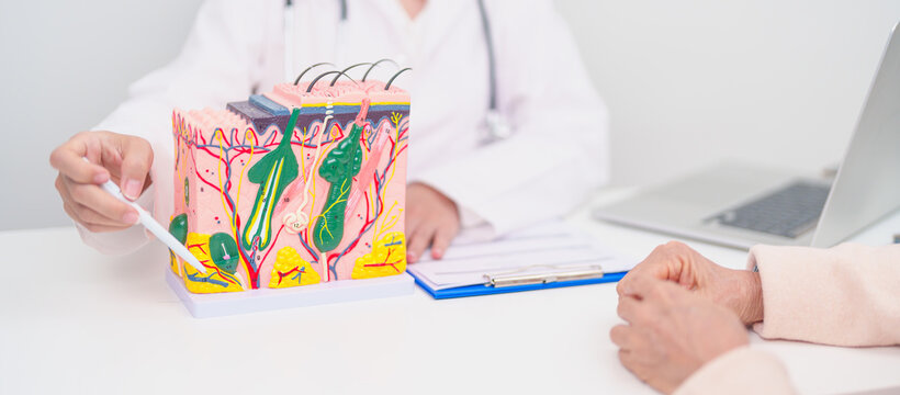 woman Patient consultation Dermatologist with anatomy of skin and hair. Skin disease and Hair loss, Systemic Lupus Erythematosus or SLE, world lupus day, May Melanoma and Skin Cancer Awareness month