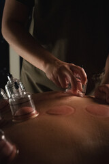 Close up cupping massage therapy treatment