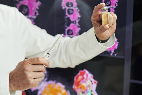 Hand of middle-aged male scientist holding vial with yellow liquid and pen, standing in front of medical imaging scans, demonstrating scientific or medical research at conference