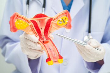 Uterus, doctor holding human anatomy model for study diagnosis and treatment in hospital.