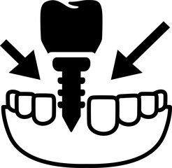 Tooth Transplantation