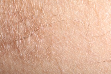 Macro view of human skin as background