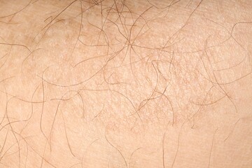 Macro view of human skin as background