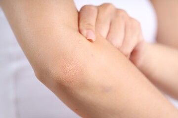 Closeup view of woman with normal skin