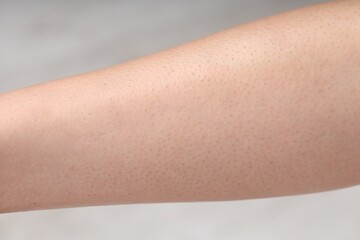 Woman with normal skin on blurred background, closeup
