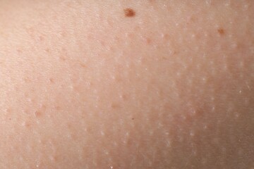 Texture of normal skin as background, closeup