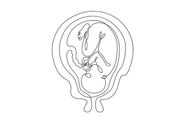 Continuous one line drawing Human embryo. Development of the human fetus. Pregnancy.Line art.One continuous line isolated illustration.Not AI.