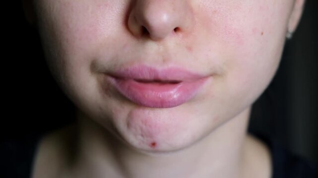 The lip trill. Sound of vibrating lips. Warming up and sound production, vocal exercises for the vocal cords and voice. Facial fitness and jaw relaxation. A female face with acne. High quality 4K.