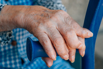 hands of a 90s woman with osteoarthritis