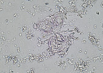 soil microorganisms under a microscope including amoeba, flagellates, nematodes, fungi, bacteria	