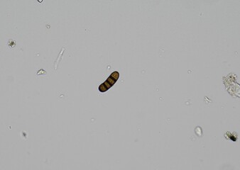soil microorganisms under a microscope including amoeba, flagellates, nematodes, fungi, bacteria	