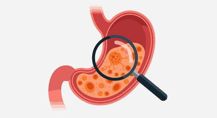 Magnifying glass examining a cancerous growth inside the stomach lining showing cellular details.
