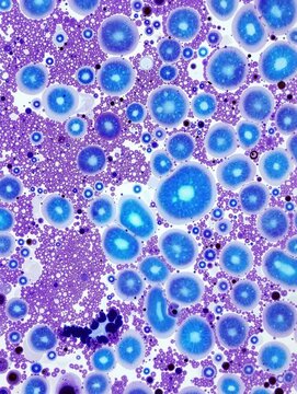 Lassa virus high magnification microscopy showing necrotic lesions and cellular degeneration