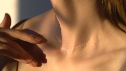 Close-up of a female neck and a large scar. Concept of Laser Surgery Scar Removal, Laser Scar treatment, Laser Resurfacing, Fractional Laser Therapy. An unrecognizable woman touches neck. Cosmetology