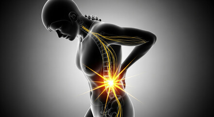 3D medical illustration of a woman with acute lower back pain. The nervous system and spine are visible with a glowing hotspot highlighting the source of the injury and ache.