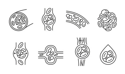 Blood clot pictograms showing vessel obstruction.