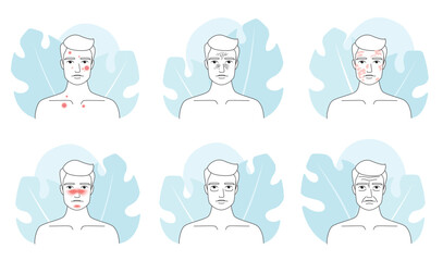 Male skin problem line icons set vector illustration. Outline man different types of medical skin troubles collection, dark circle under eyes and wrinkles, acne and melasma, blackheads and rosacea