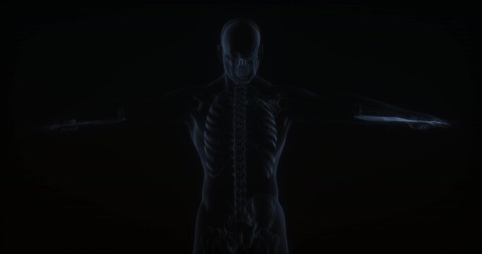 Flexor digitorum superficialis muscle in human body. X Ray. Loop