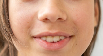 Fototapeta premium optimistic cheerful teenage boy with wide and genuine smile, open-mouthed smiling, dental health, candid closeup portrait, moment pure happiness and youthful joy, positive emotion childhood