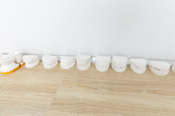 Row of Dental casting gypsum models plaster cast on a table