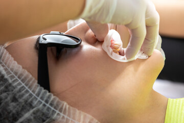 Dentist installing a patient cheek retractor in dentist office