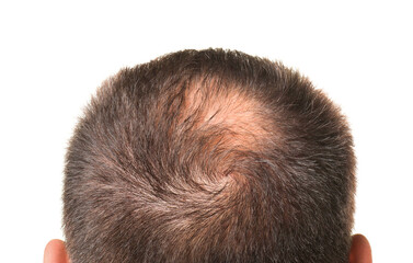 Man with bald spot on white background, back view