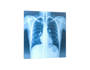 Radiographic view of the human chest, showing bones and internal organs