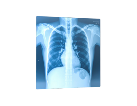 Radiographic view of the human chest, showing bones and internal organs