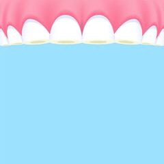 Upper teeth (Attrition) - Text box banner (square) illustration vector design. Dental care concept.