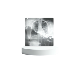 Medical chest x-ray displayed on a white podium, against a black backdrop