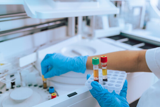 Female laboratory researcher holding blood test tubes and adjusting an automatic biochemistry analyzer machine.