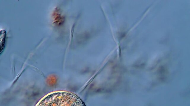 Protozoan in pond water, microscope view 400x 