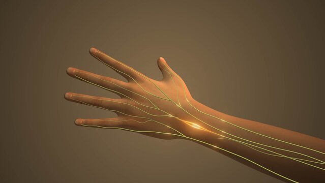 Radiating pain from the hand tumor