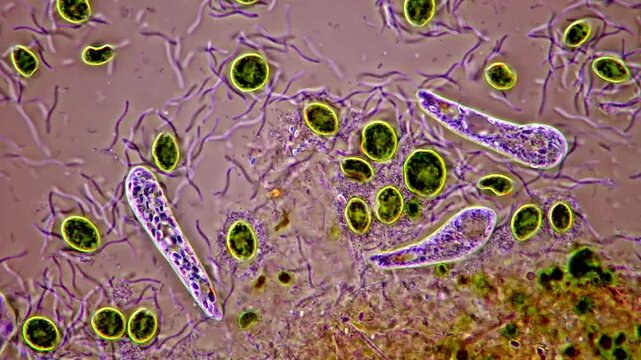 Green algae, protozoa and bacteria under microscope 