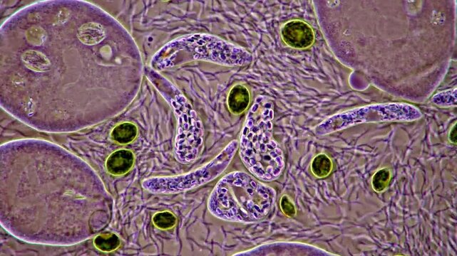 Microorganism under microscopy view, euglena, paramecium, algae and bacteria 
