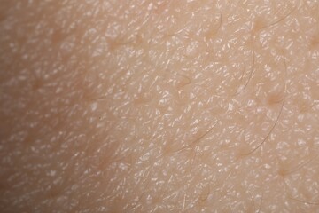 Macro view of human skin as background
