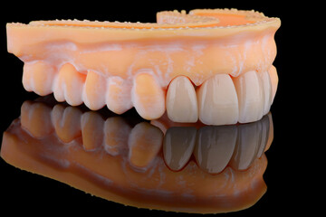 High-quality four dental crowns made of zirconium for fixation to the frontal teeth of upper jaw.