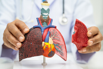 Pneumonia, lung cancer, Asian doctor holding human anatomy model for study diagnosis and treatment in hospital.