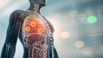 Conceptual medical illustration of human anatomy showing lung cancer tumor disease. serious view of patient torso for oncology