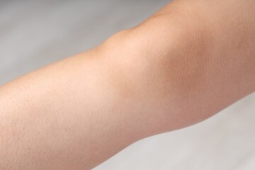 Woman with normal skin on blurred background, closeup