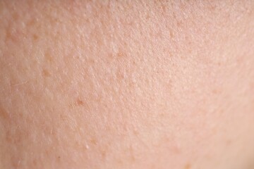 Texture of normal skin as background, closeup