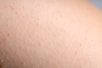 Texture of normal skin as background, closeup