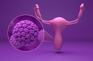 Human papillomavirus (HPV) - isometric view 3d illustration