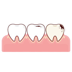 Teeth decay on the gums cartoon cute