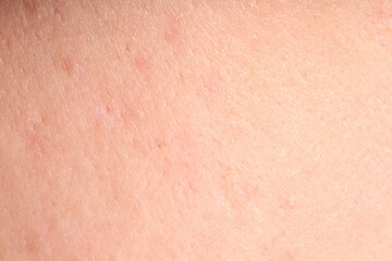 Fototapeta premium Human skin, closeup view. Detailed texture of surface