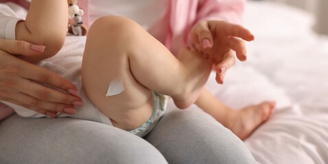 Mother and baby with cream on his leg at home, closeup